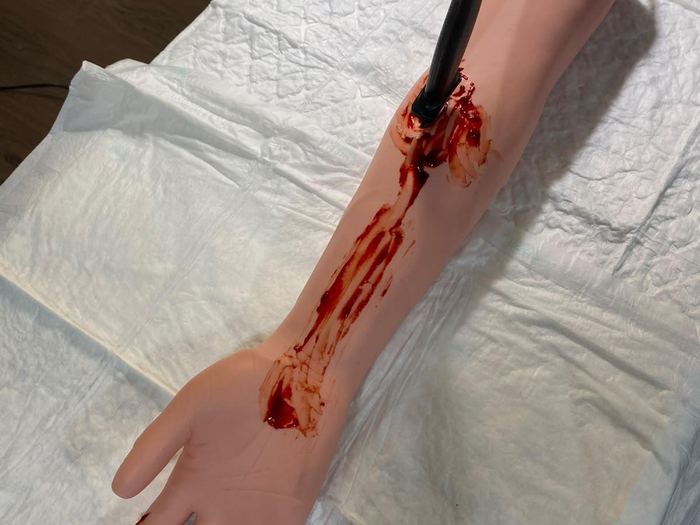 Brazo de simulación con objeto clavado y hemorragia para practicar el control del sangrado